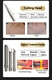 vaginal tightening machine
